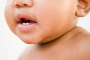 Baby teeth