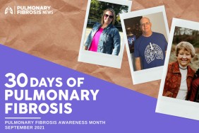 pulmonary fibrosis