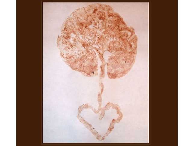 Make a Placenta Print.